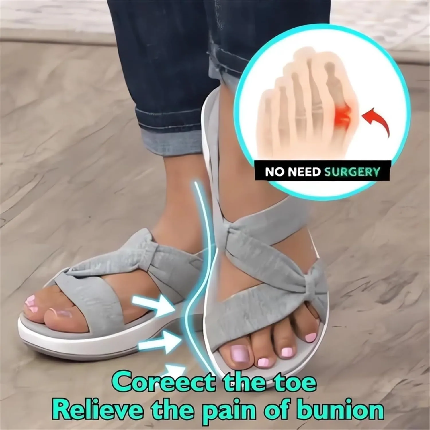 Women's Summer Sandals Orthopedic Arch Support Walking Shoes Casual Orthotic Low Platform Wedges Sandals With Back Strap
