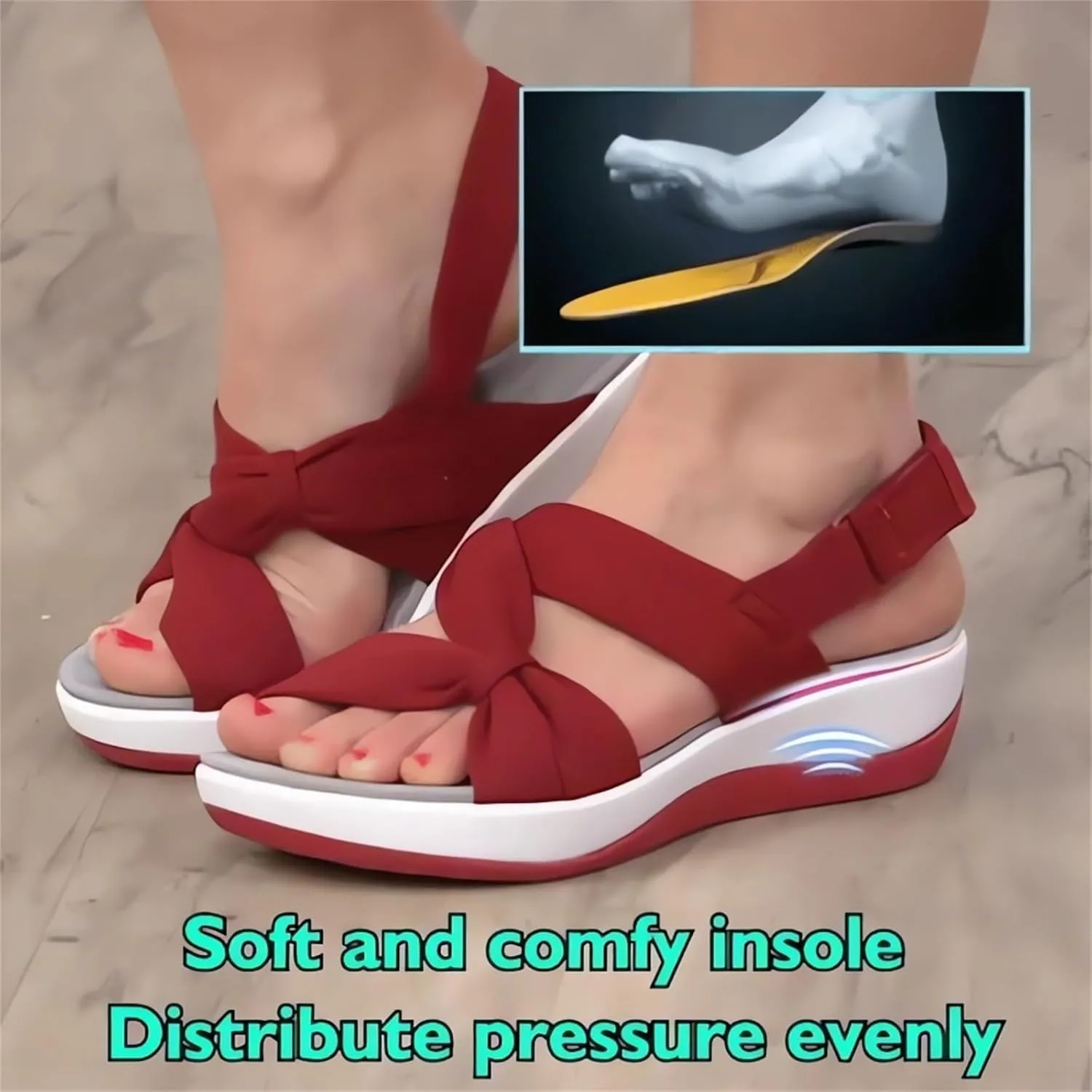 Women's Summer Sandals Orthopedic Arch Support Walking Shoes Casual Orthotic Low Platform Wedges Sandals With Back Strap